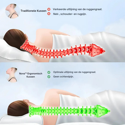 Nova™ Ergonomisch Kussen